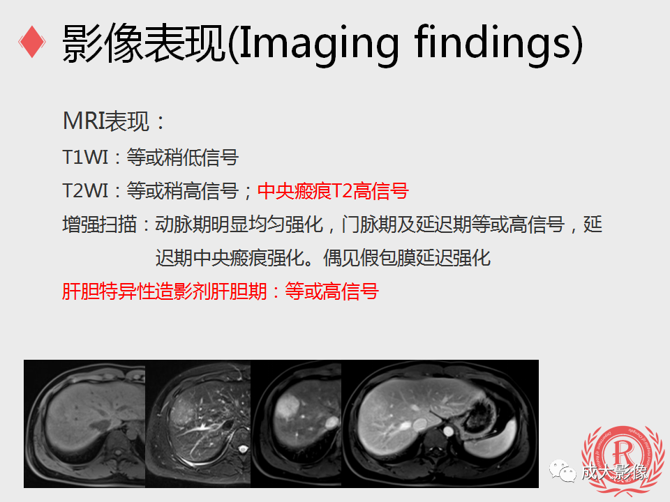 影像PPT - 【PPT】局灶性结节增生的影像表现-9