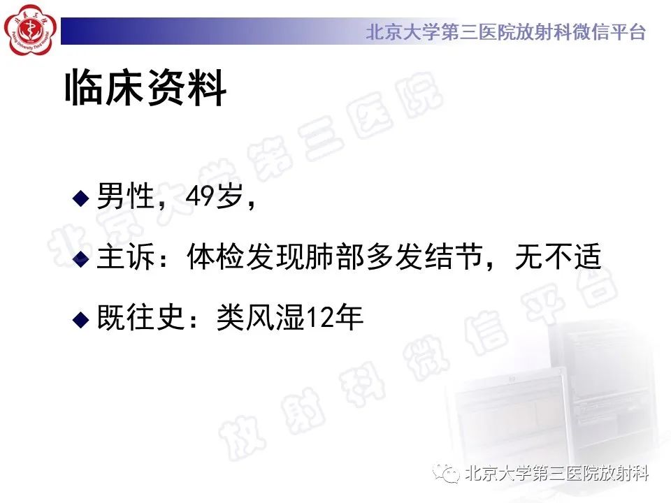 影像PPT - 【PPT】肺类风湿结节-2