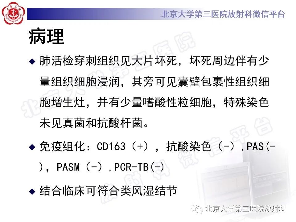 影像PPT - 【PPT】肺类风湿结节-8