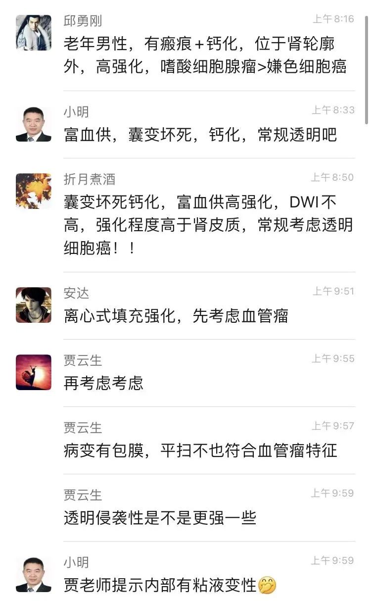 影像PPT - 【病例】肾脏嗜酸细胞瘤1例CT及MR-11