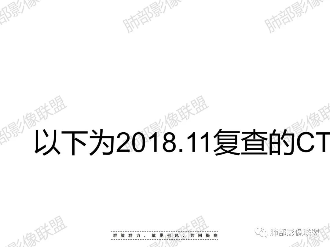影像PPT - 【病例】宝塔样或葫芦样多结节聚合征—原发性肺肉瘤样癌1例CT-55 影像PPT - 【病例】宝塔样或葫芦样多结节聚合征—原发性肺肉瘤样癌1例CT-55
