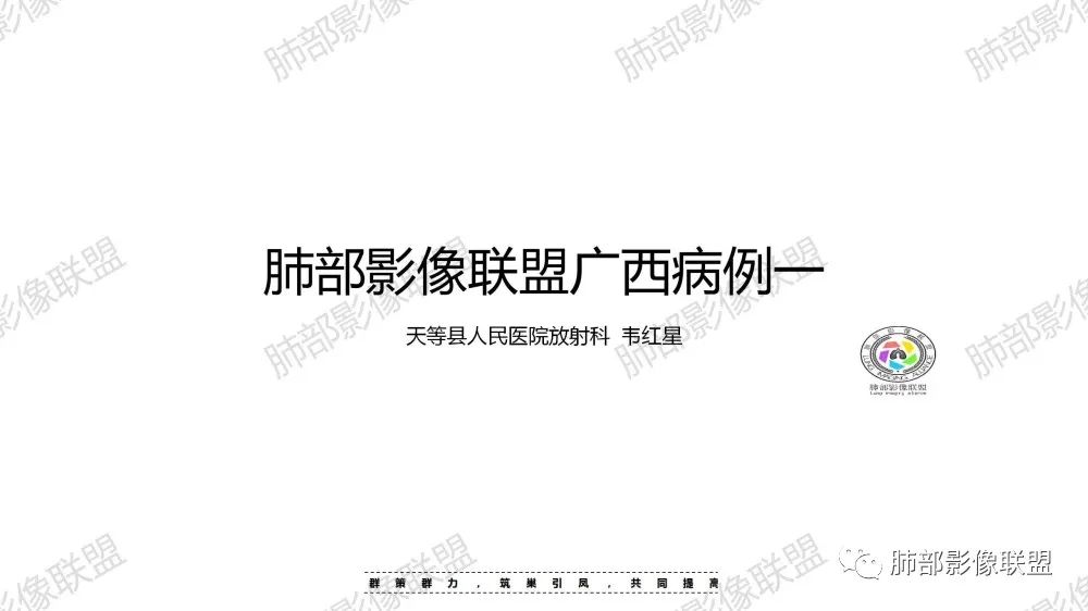 影像PPT - 【病例】鹦鹉热衣原体肺炎1例CT影像-1 影像PPT - 【病例】鹦鹉热衣原体肺炎1例CT影像-1