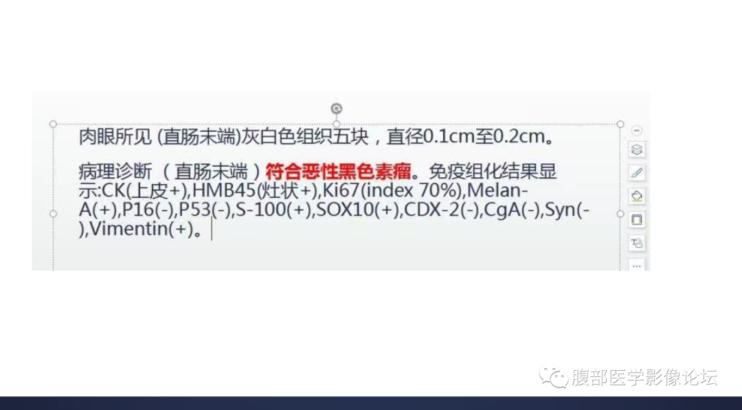 影像PPT - 【病例】直肠恶性黑色素瘤1例CT影像-14 影像PPT - 【病例】直肠恶性黑色素瘤1例CT影像-14