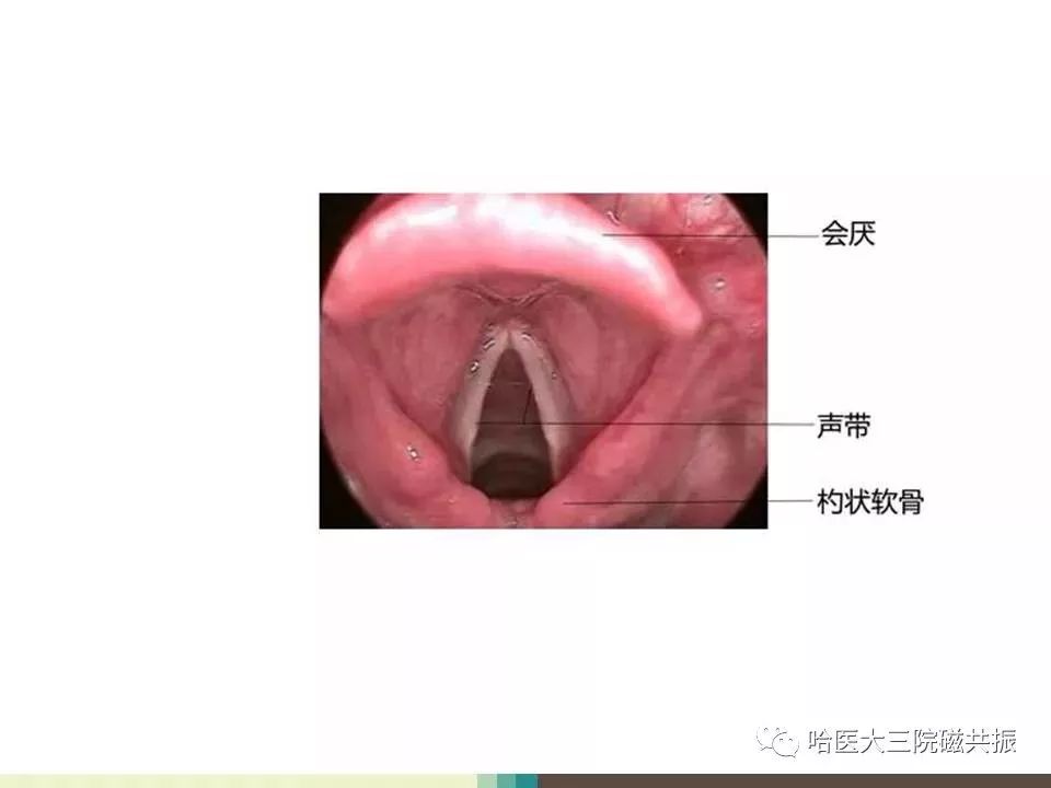 影像PPT - 【PPT】喉癌与磁共振成像-5