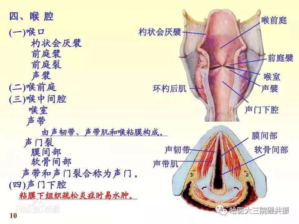 影像PPT - 【PPT】喉癌与磁共振成像-4