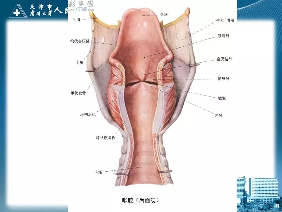 影像PPT - 【PPT】喉的应用解剖与影像解剖-10