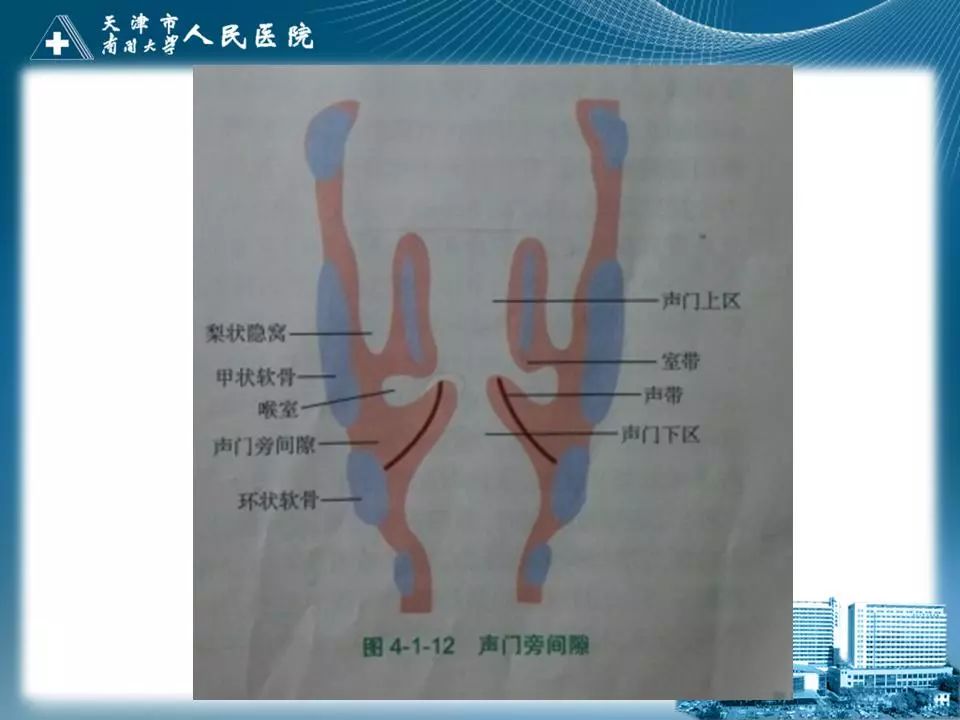 影像PPT - 【PPT】喉的应用解剖与影像解剖-12