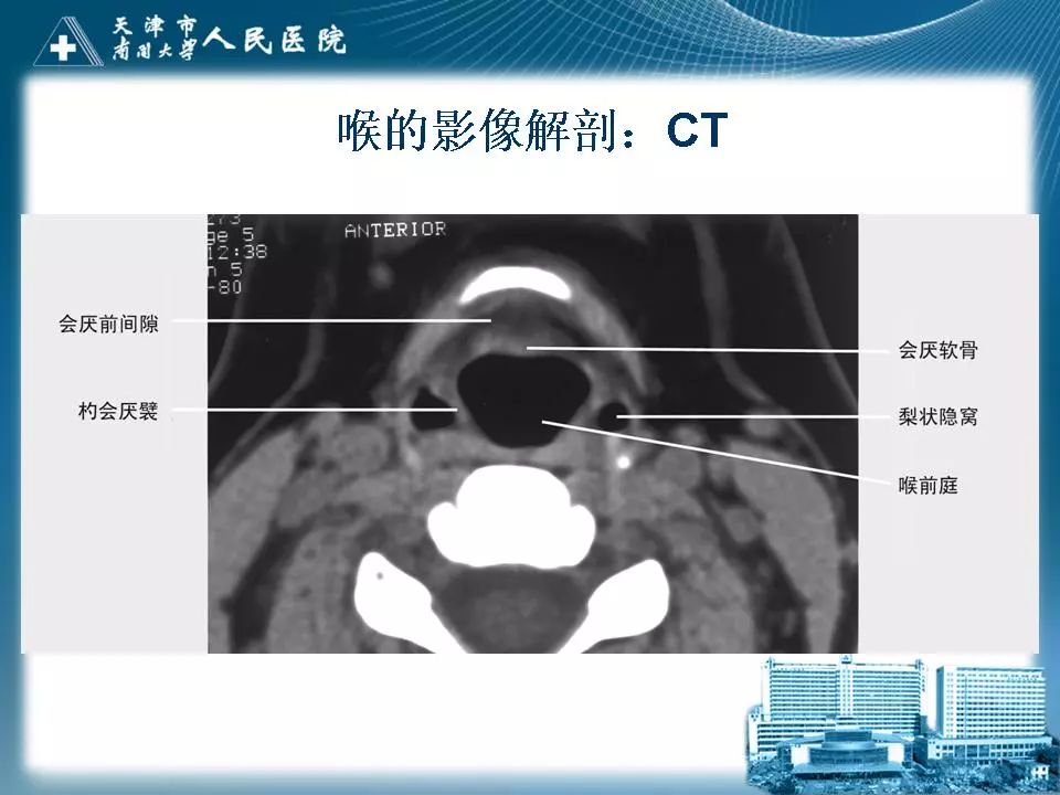 影像PPT - 【PPT】喉的应用解剖与影像解剖-19