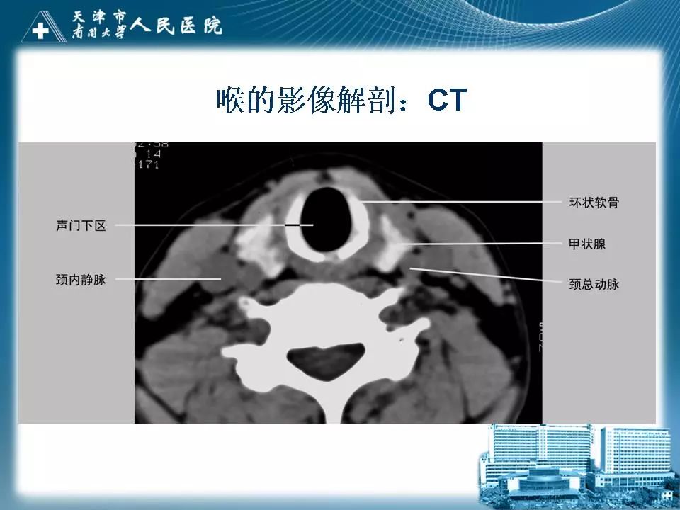 影像PPT - 【PPT】喉的应用解剖与影像解剖-22