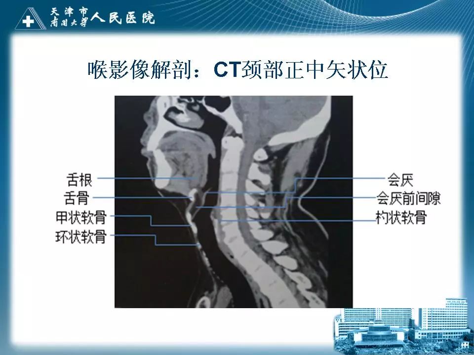 影像PPT - 【PPT】喉的应用解剖与影像解剖-23