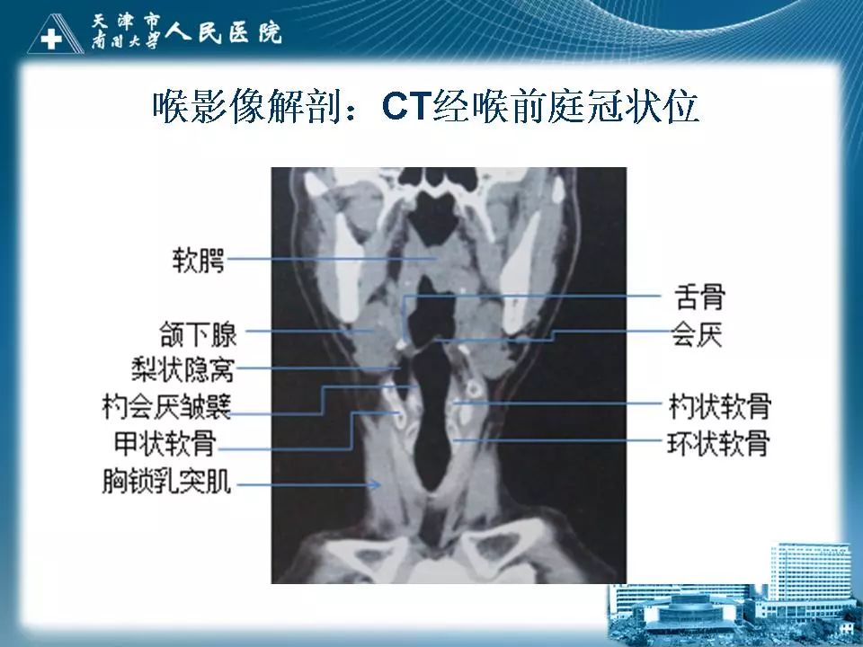 影像PPT - 【PPT】喉的应用解剖与影像解剖-24