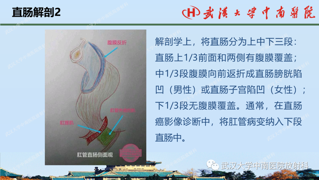 影像PPT - 【PPT】直肠癌的MRI诊断及分期-4