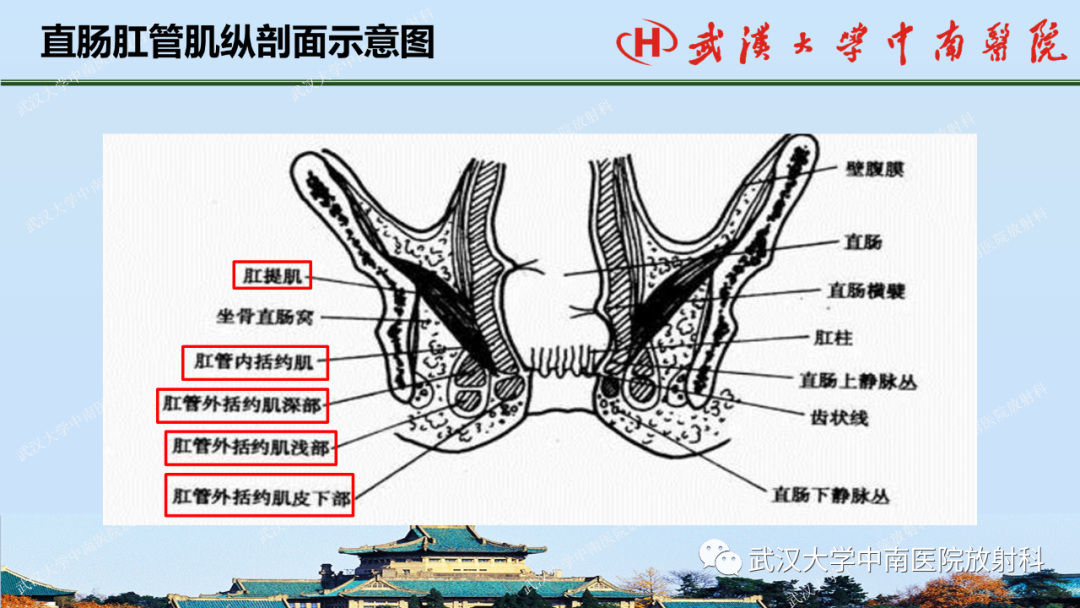 影像PPT - 【PPT】直肠癌的MRI诊断及分期-7