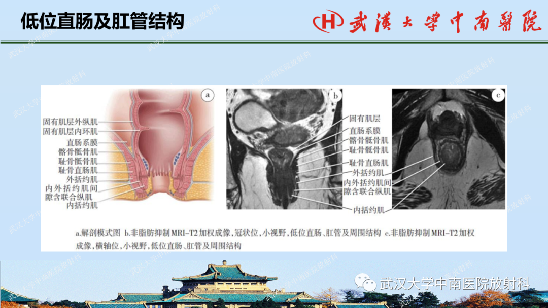 影像PPT - 【PPT】直肠癌的MRI诊断及分期-8