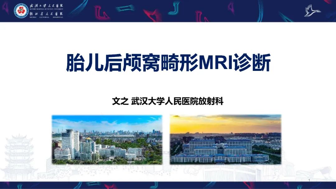 影像PPT - 【PPT】胎儿后颅窝畸形MRI诊断-1