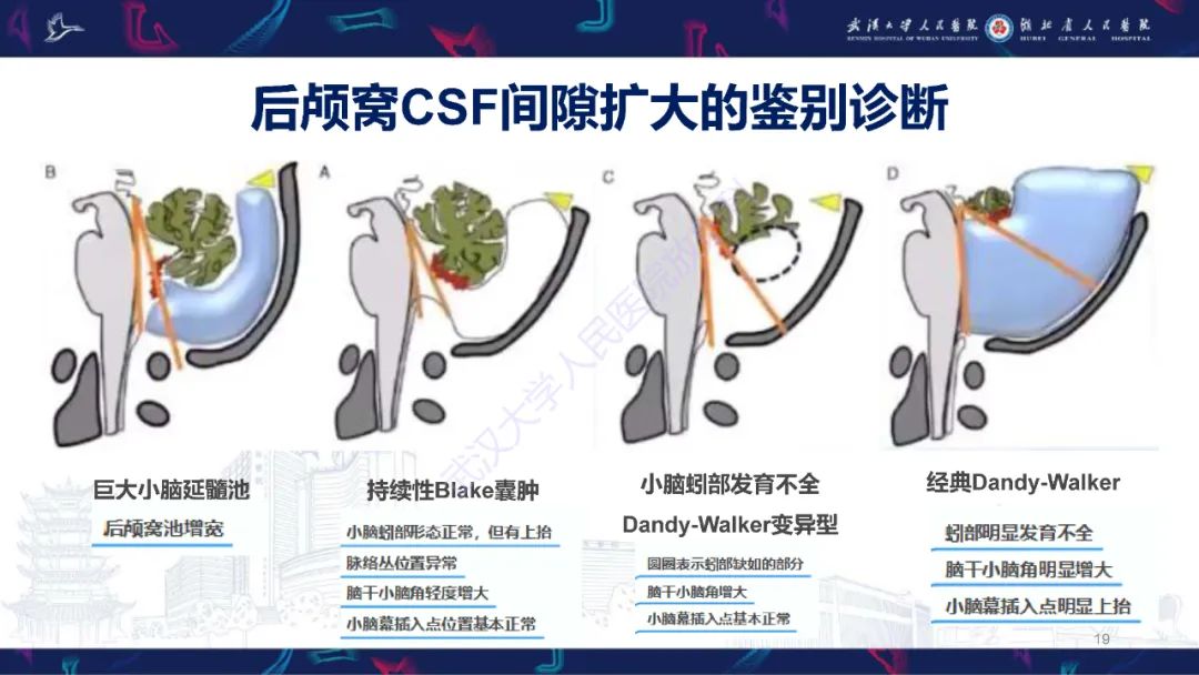 影像PPT - 【PPT】胎儿后颅窝畸形MRI诊断-19