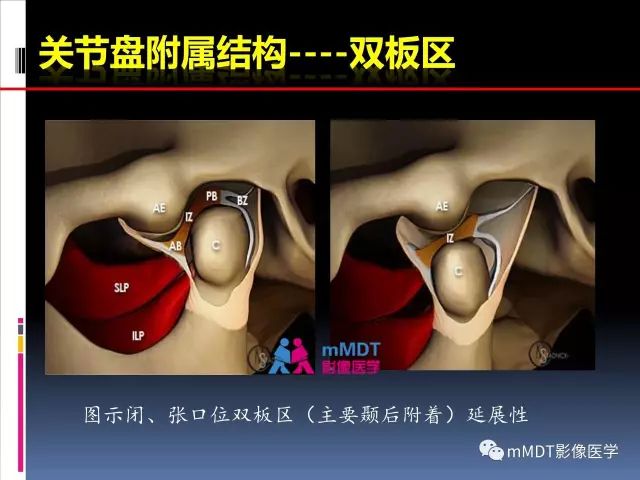 影像PPT - 【PPT】颞下颌关节的磁共振成像（检查技术与解剖部分）-27