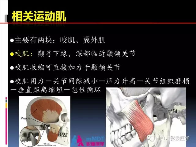 影像PPT - 【PPT】颞下颌关节的磁共振成像（检查技术与解剖部分）-30
