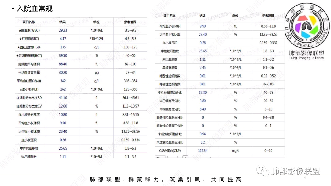 影像PPT - 【病例】 支扩基础上的感染,如何厘清头绪?-4 影像PPT - 【病例】 支扩基础上的感染,如何厘清头绪?-4