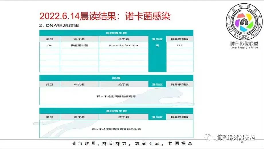 影像PPT - 【病例】 支扩基础上的感染,如何厘清头绪?-51 影像PPT - 【病例】 支扩基础上的感染,如何厘清头绪?-51