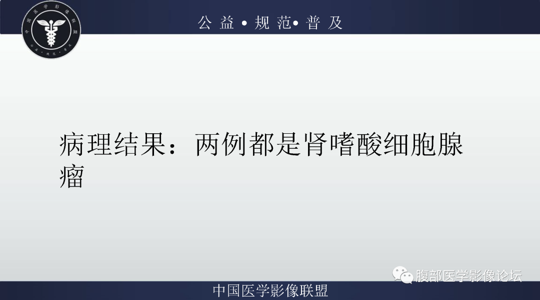 影像PPT - 【病例】肾脏嗜酸细胞腺瘤2例CT影像-14 影像PPT - 【病例】肾脏嗜酸细胞腺瘤2例CT影像-14