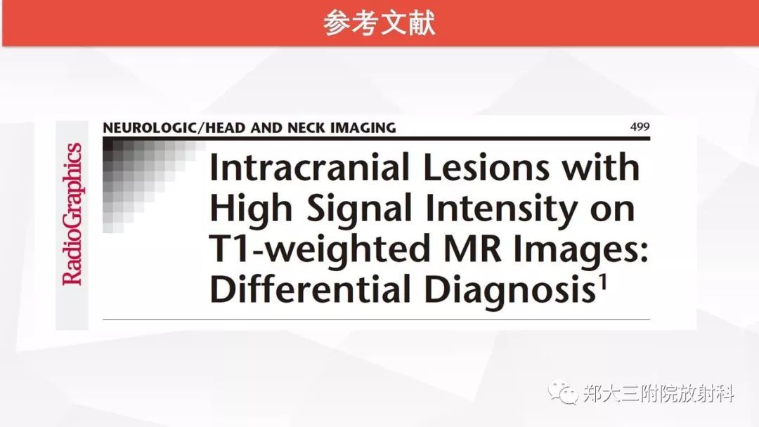 影像PPT - 【PPT】颅内T1WI高信号病变的影像鉴别诊断-49