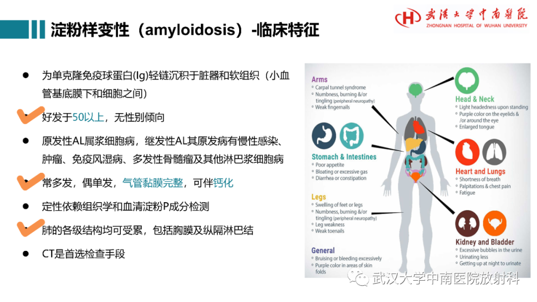 影像PPT - 【病例】复发性多软骨炎1例影像鉴别诊断-17