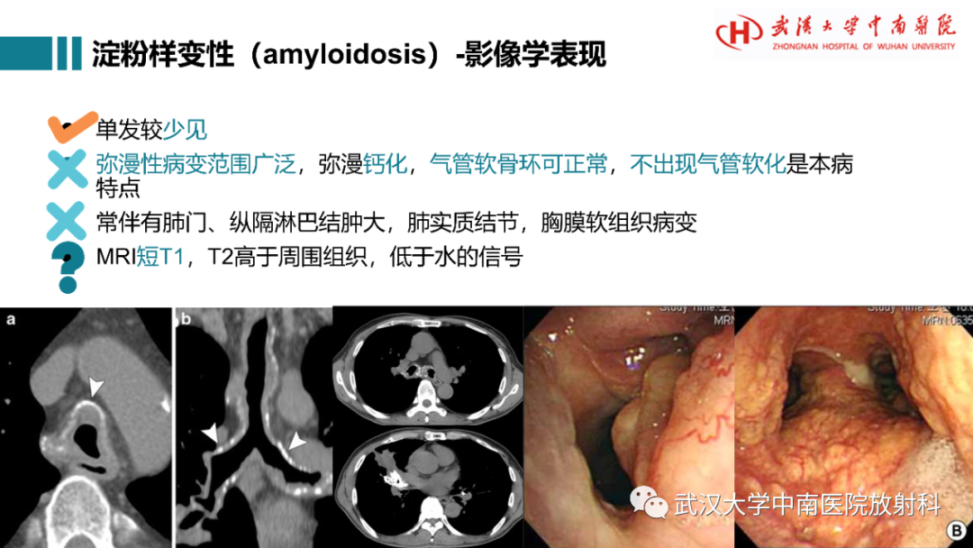 影像PPT - 【病例】复发性多软骨炎1例影像鉴别诊断-19