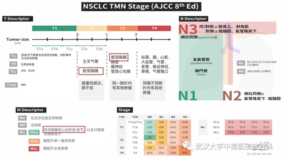影像PPT - 【PPT】如何影像评估肺癌胸膜侵犯-2