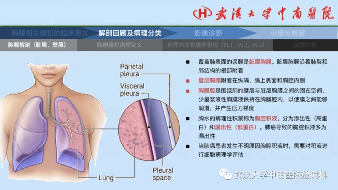 影像PPT - 【PPT】如何影像评估肺癌胸膜侵犯-7