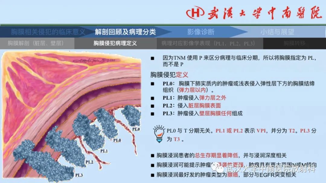 影像PPT - 【PPT】如何影像评估肺癌胸膜侵犯-11