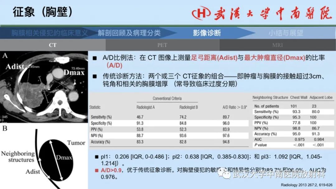 影像PPT - 【PPT】如何影像评估肺癌胸膜侵犯-31