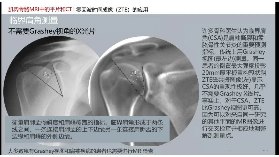 影像PPT - 【PPT】肌肉骨骼MRI中的平片和CT——零回波时间（ZTE）成像的挑战、优化和应用-29