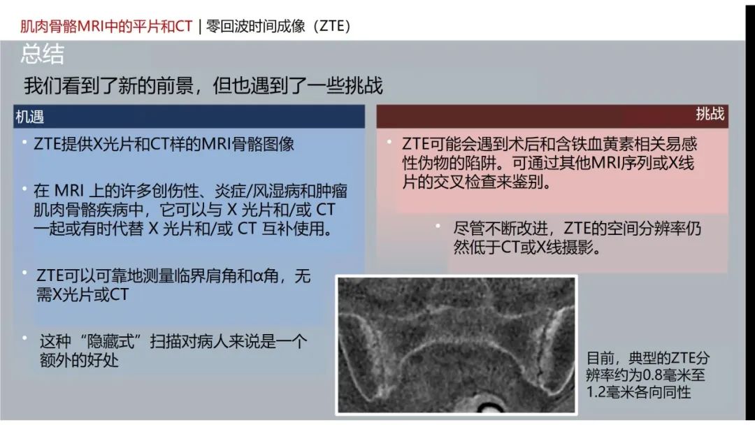影像PPT - 【PPT】肌肉骨骼MRI中的平片和CT——零回波时间（ZTE）成像的挑战、优化和应用-57
