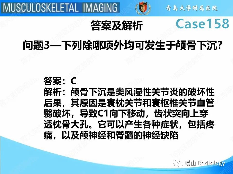 影像PPT - 【PPT】寰枢关节不稳定-8