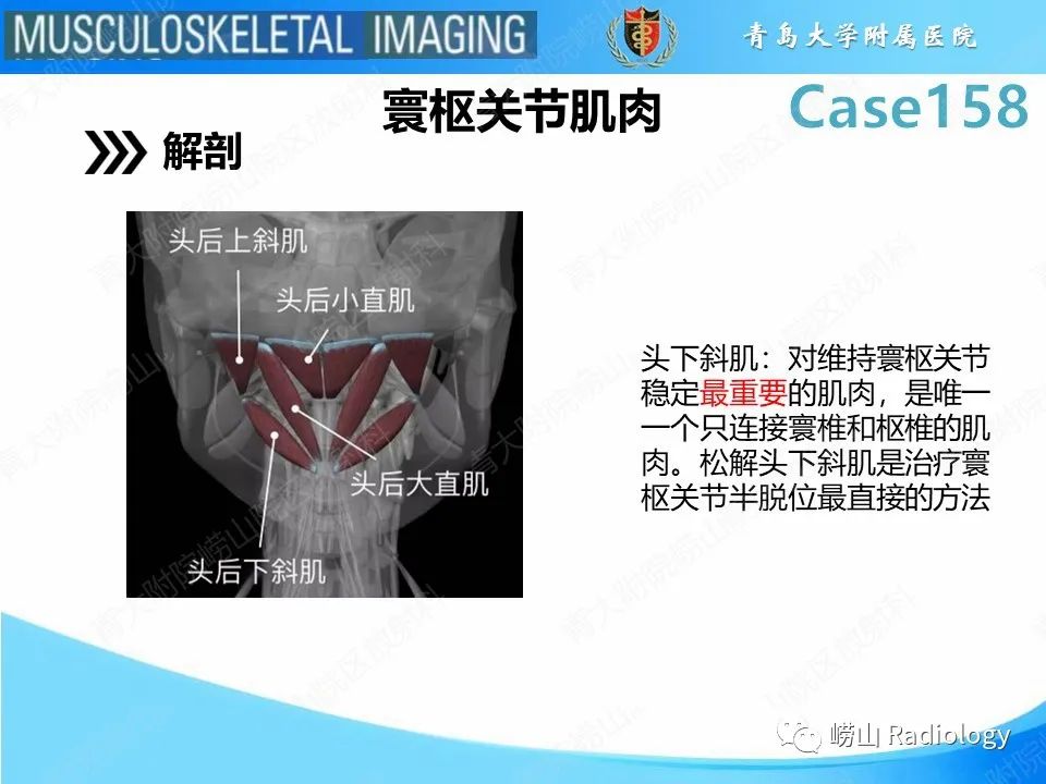 影像PPT - 【PPT】寰枢关节不稳定-13