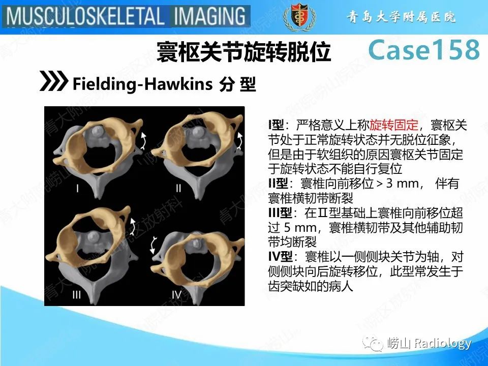 影像PPT - 【PPT】寰枢关节不稳定-19