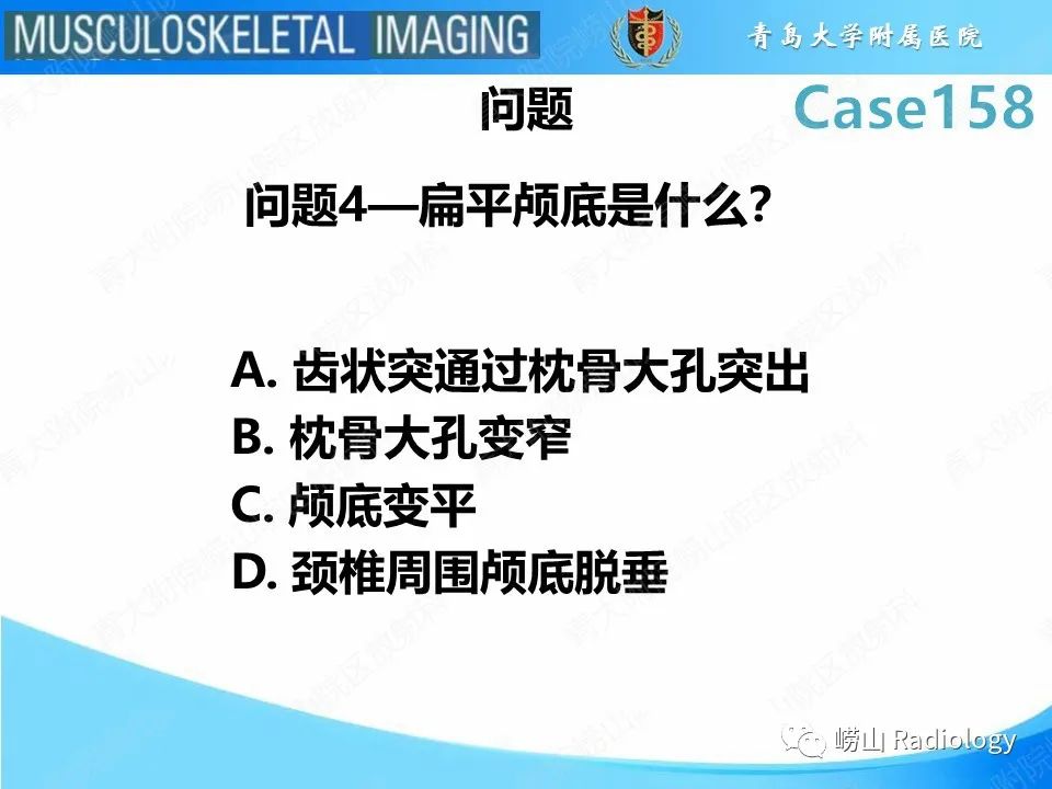影像PPT - 【PPT】寰枢关节不稳定-1