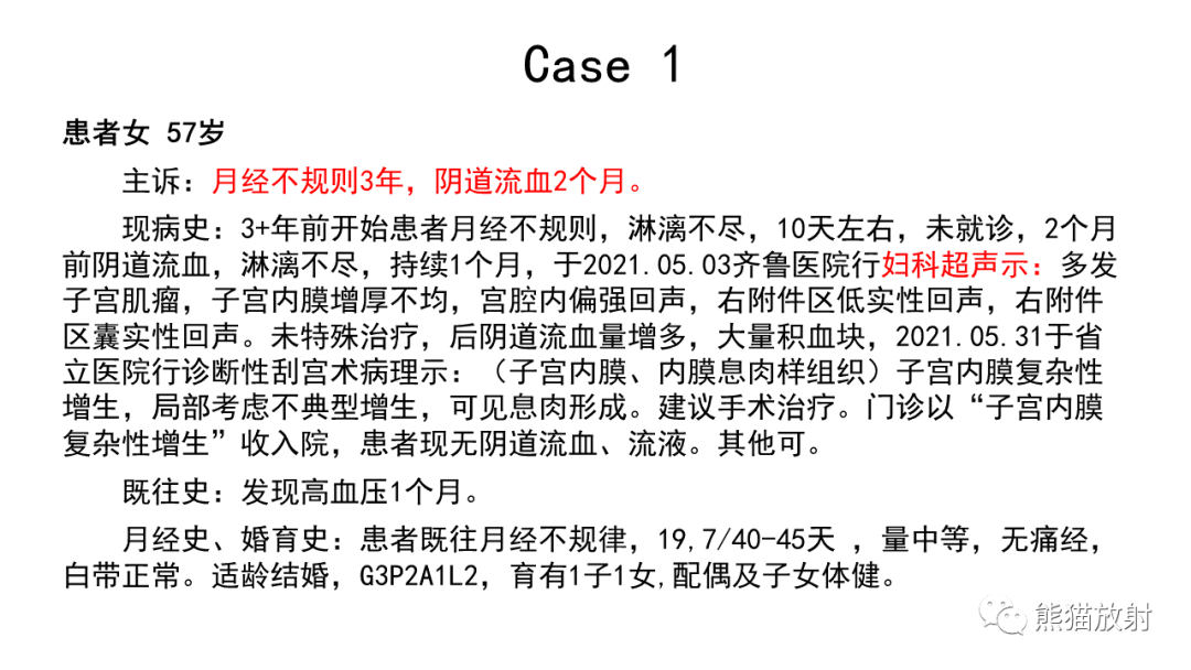 影像PPT - 【病例】卵巢Brenner瘤2例CT及MR影像-2