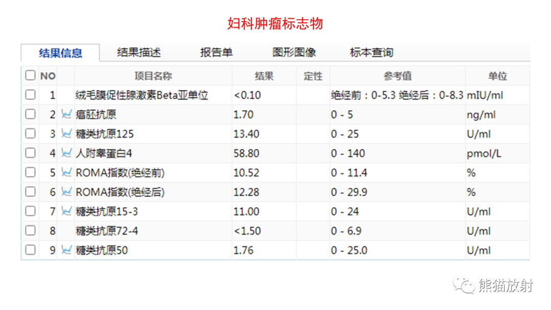 影像PPT - 【病例】卵巢Brenner瘤2例CT及MR影像-3