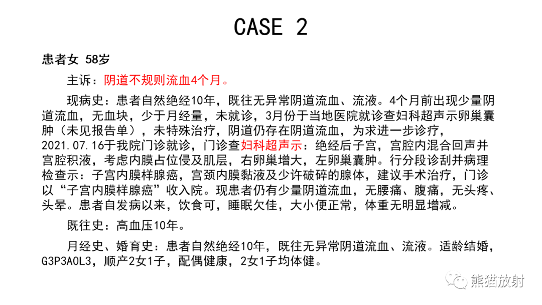影像PPT - 【病例】卵巢Brenner瘤2例CT及MR影像-14