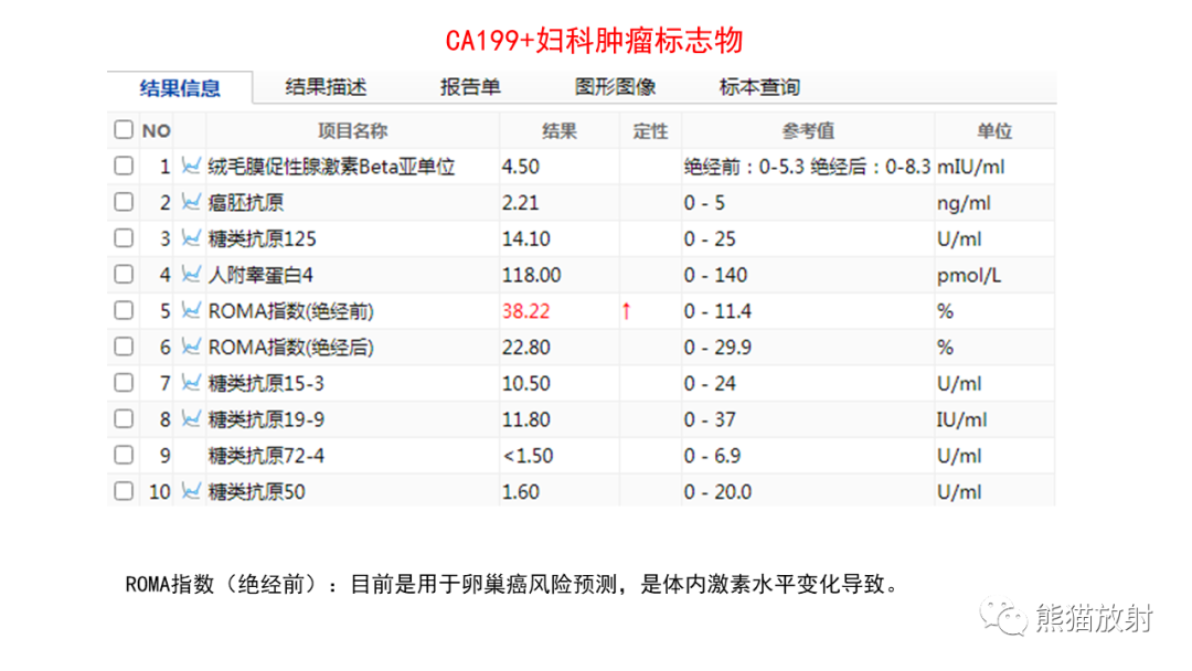 影像PPT - 【病例】卵巢Brenner瘤2例CT及MR影像-15