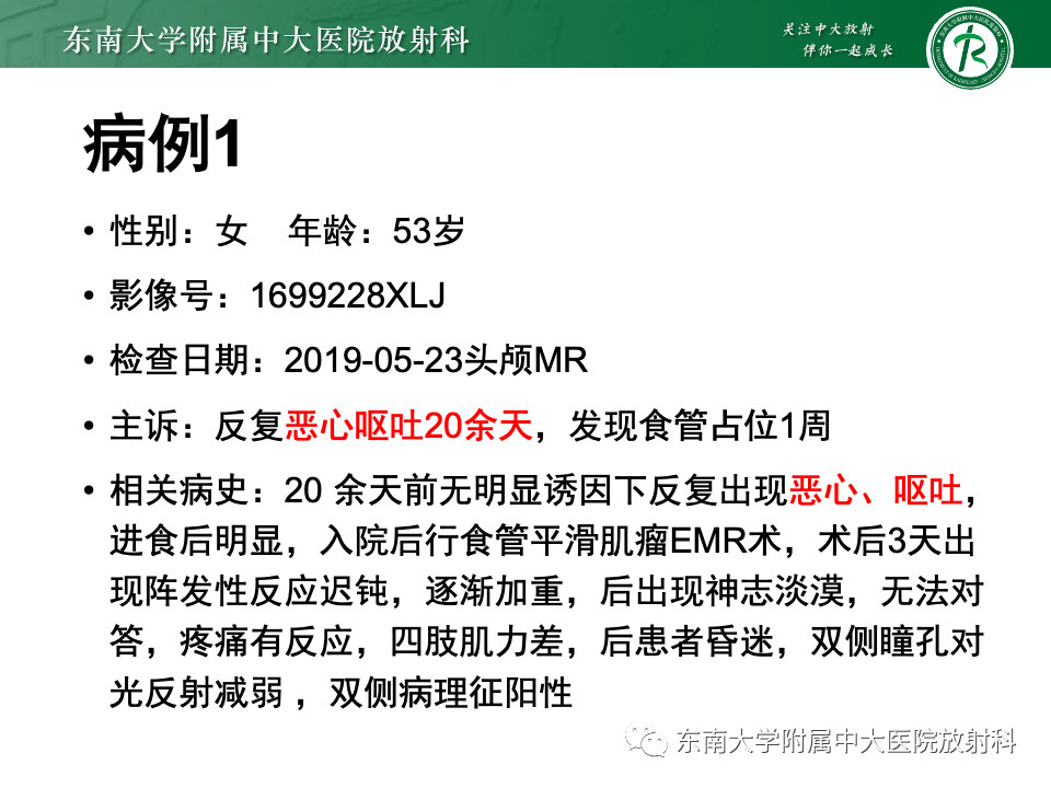 影像PPT - 【PPT】Wernicke脑病-2 影像PPT - 【PPT】Wernicke脑病-2