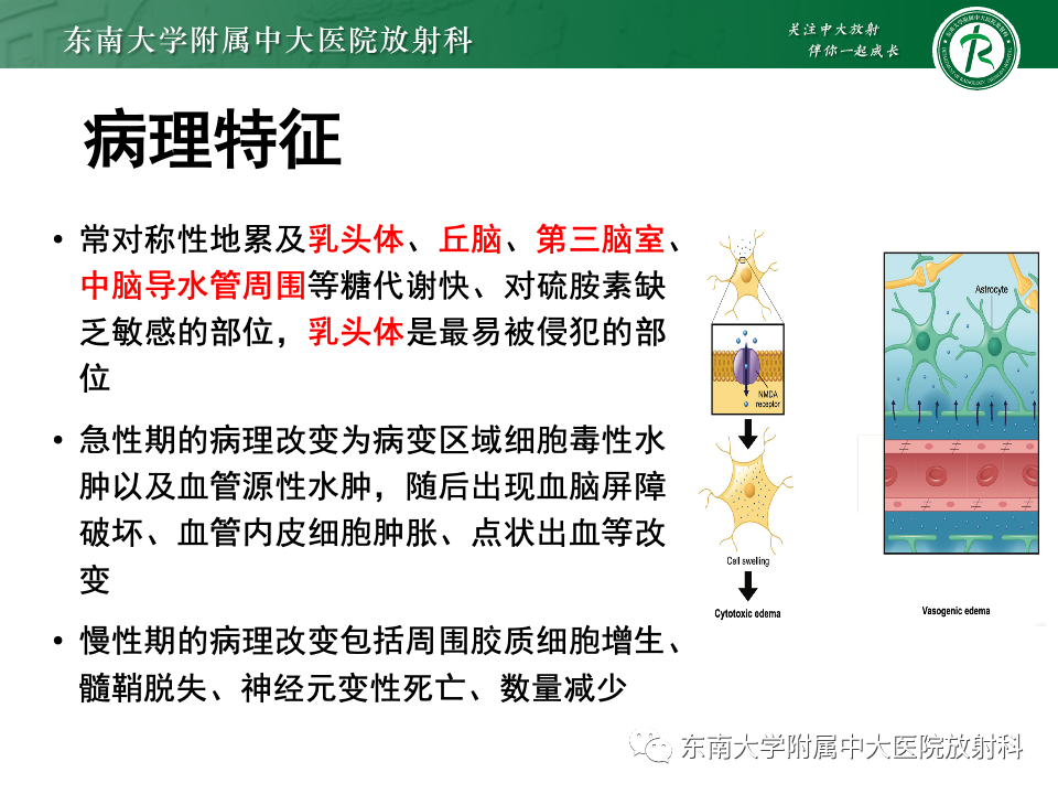 影像PPT - 【PPT】Wernicke脑病-9 影像PPT - 【PPT】Wernicke脑病-9