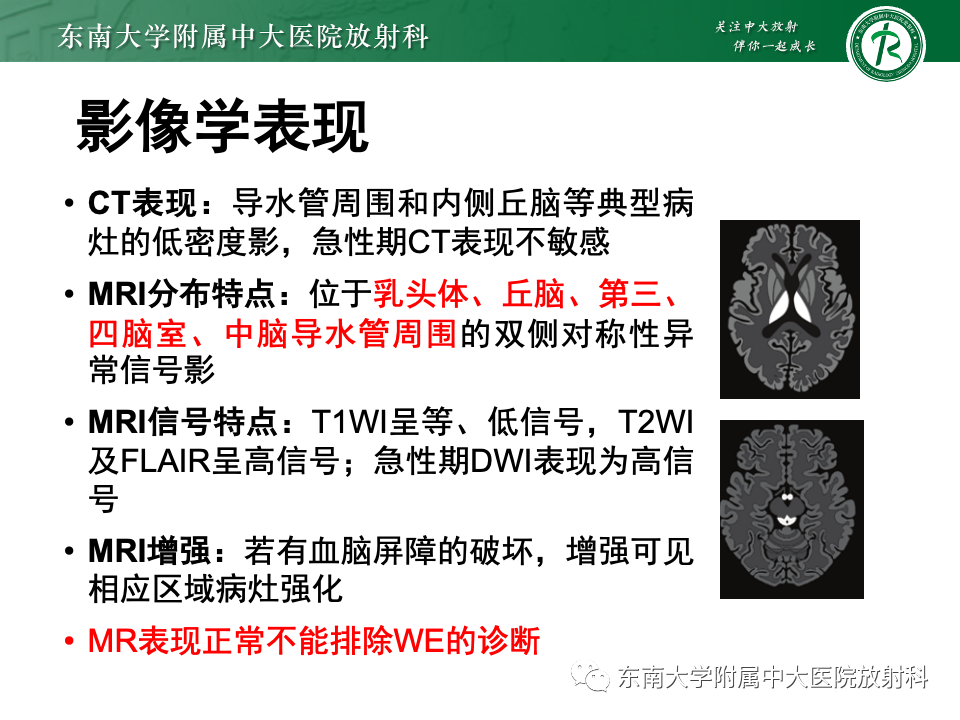 影像PPT - 【PPT】Wernicke脑病-13 影像PPT - 【PPT】Wernicke脑病-13