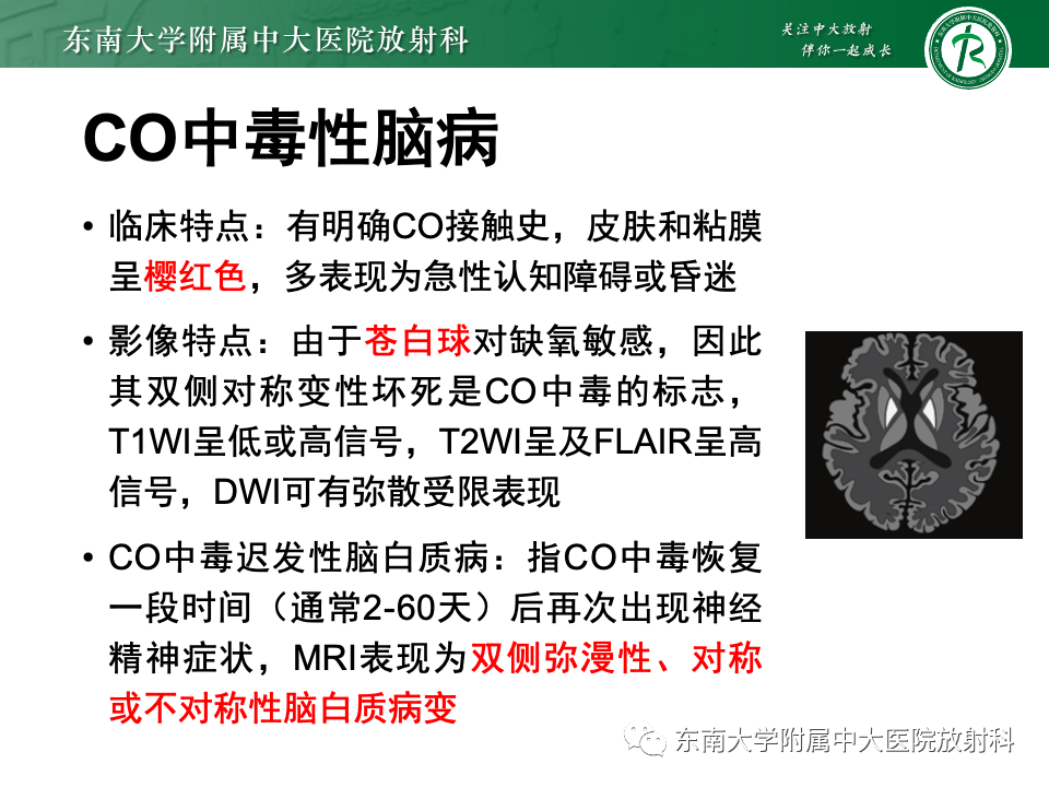 影像PPT - 【PPT】Wernicke脑病-20 影像PPT - 【PPT】Wernicke脑病-20