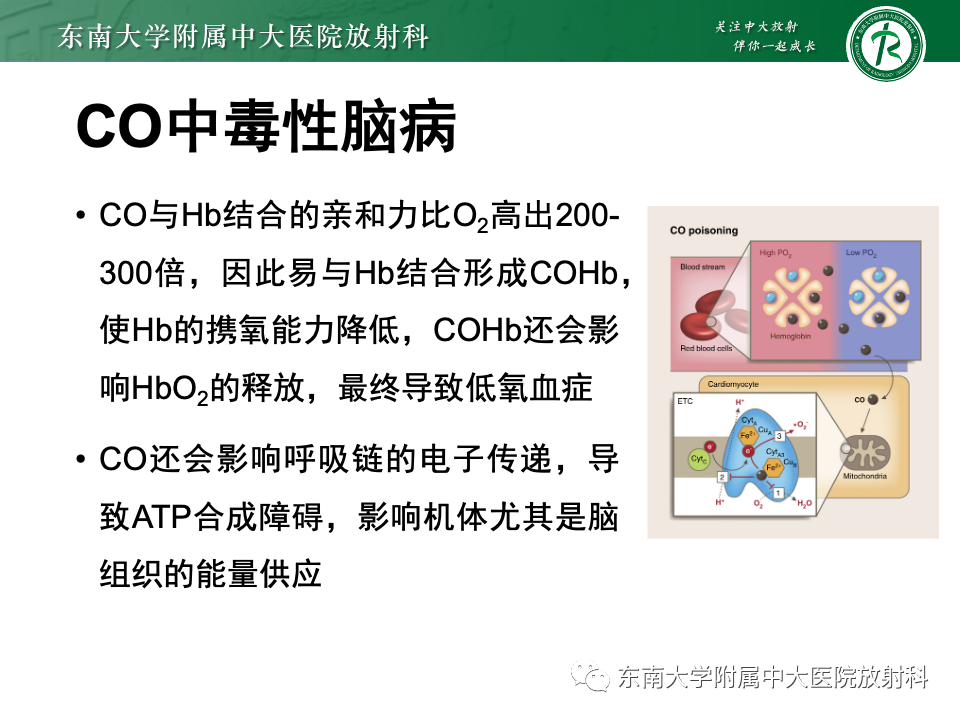 影像PPT - 【PPT】Wernicke脑病-19 影像PPT - 【PPT】Wernicke脑病-19