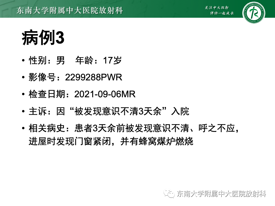 影像PPT - 【PPT】Wernicke脑病-21 影像PPT - 【PPT】Wernicke脑病-21