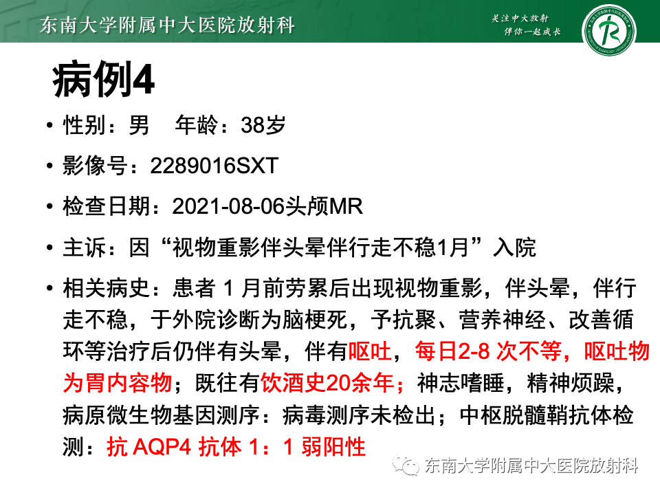 影像PPT - 【PPT】Wernicke脑病-28 影像PPT - 【PPT】Wernicke脑病-28