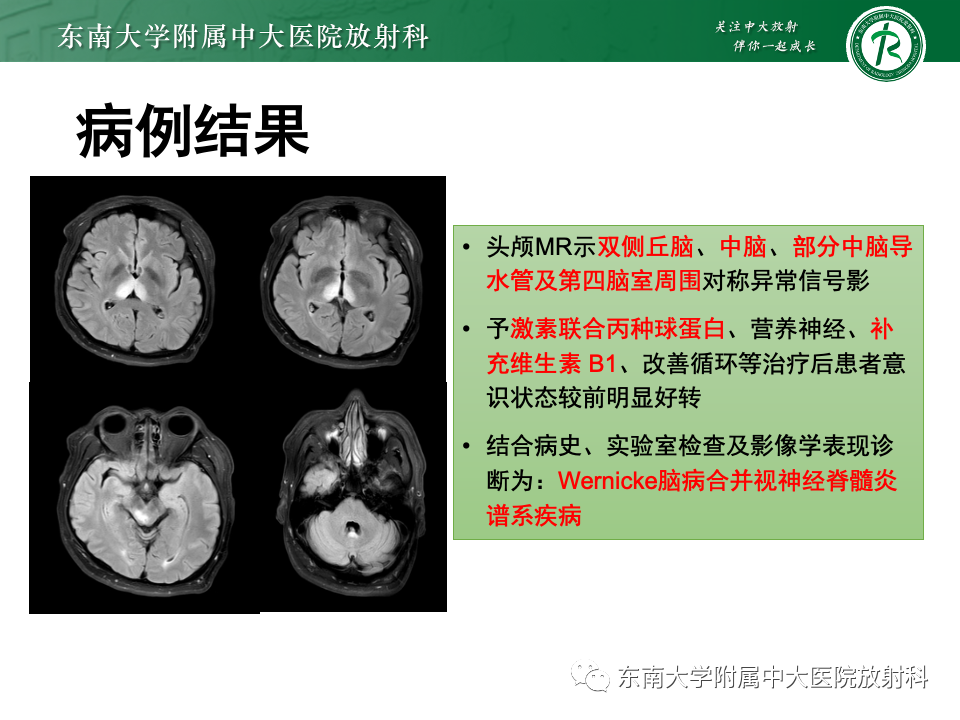影像PPT - 【PPT】Wernicke脑病-29 影像PPT - 【PPT】Wernicke脑病-29